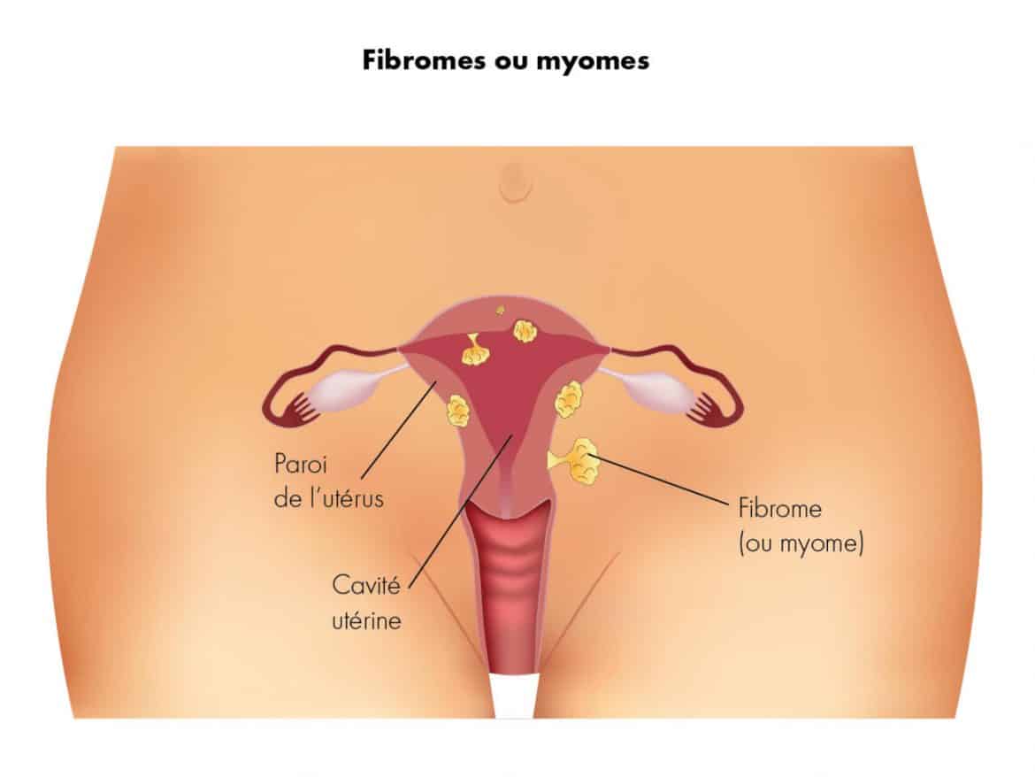 adherences-chirurgie.fr__0