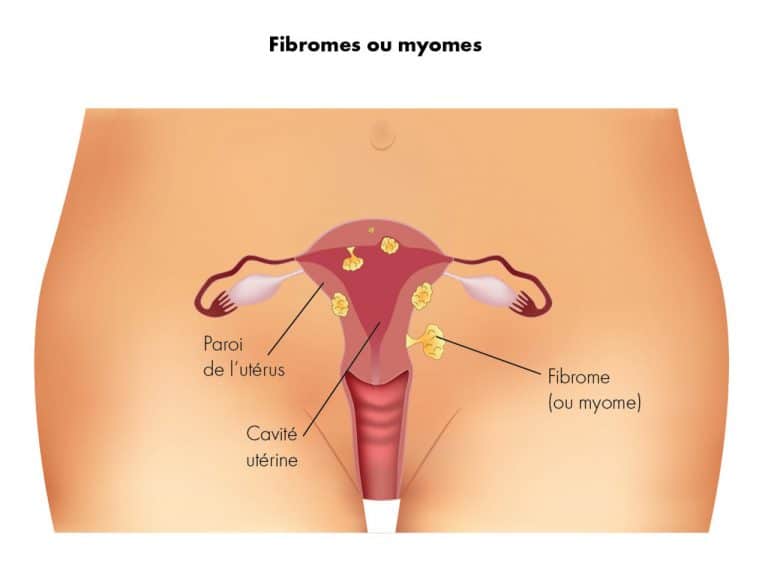 adherences-chirurgie.fr__0